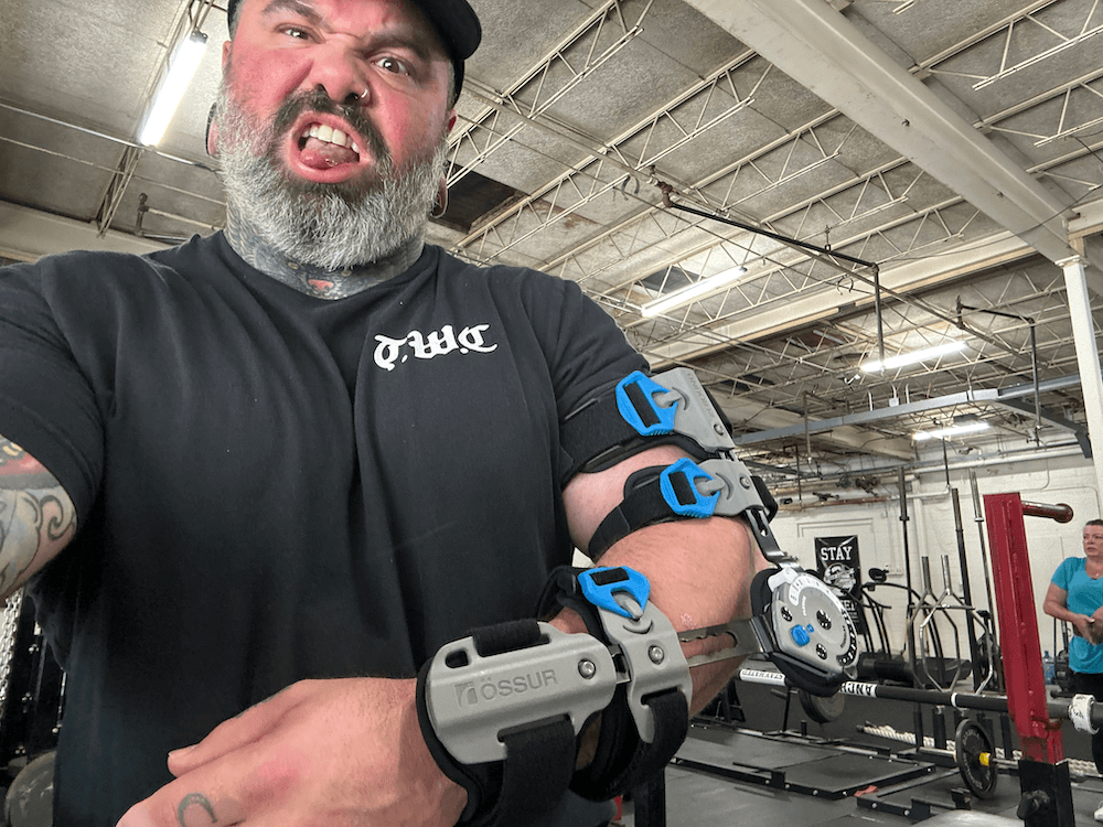 ELBOW INJURY UPDATE AND THE WPO IS 11 WEEKS OUT